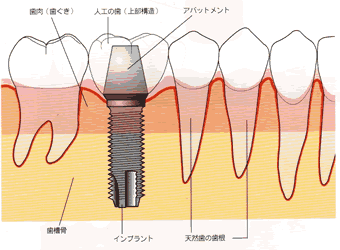 �C���v�����g